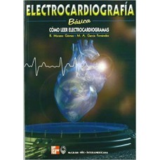 ELECTROCARDIOGRAFIA BASICA